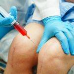 Cortisone Shots Uses, Side Effects, Cost & More